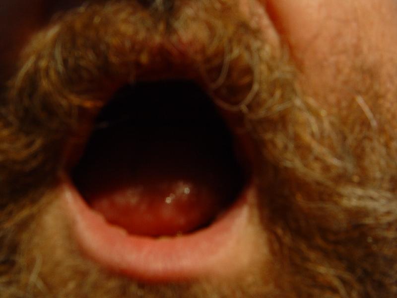 DSC08692 